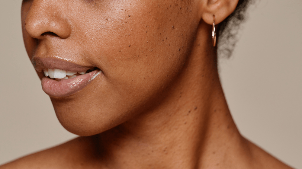 Comment savoir notre type de peau 1 Les principaux types de peau